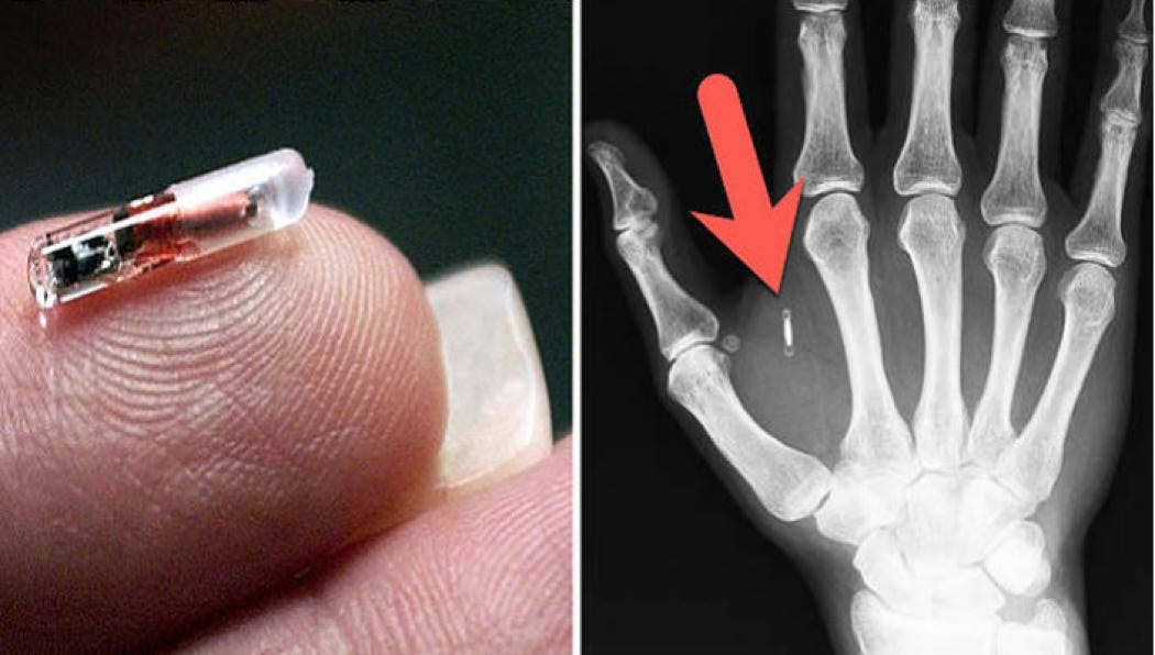 il microchip impiantato nella mano destra